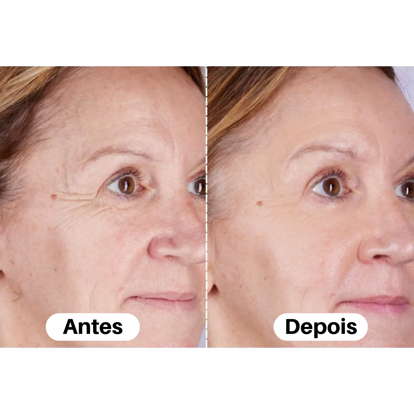 Máscara LED Facial Premium – Tratamento Completo de Pele em Casa