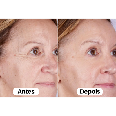 Máscara LED Facial Premium – Tratamento Completo de Pele em Casa