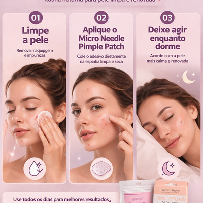 Acabe com Espinhas sem Deixar Manchas
