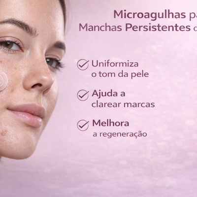 Acabe com Espinhas sem Deixar Manchas